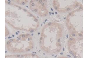 Detection of FIS1 in Human Kidney Tissue using Polyclonal Antibody to Fission 1 (FIS1)