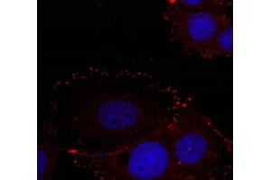 Immunofluorescence staining of methanol-fixed Hela cells using FAK(phospho-Tyr576/Tyr577) Antibody. (FAK 抗体  (pTyr576, pTyr577))