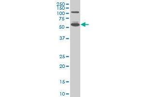 IRF5 monoclonal antibody (M05A), clone 2D4 Western Blot analysis of IRF5 expression in A-431 ( Cat # L015V1 ). (IRF5 抗体  (AA 395-504))
