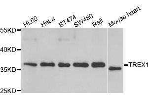 Western blot analysis of extracts of various cell lines, using TREX1 antibody (ABIN5974106) at 1/1000 dilution. (TREX1 抗体)