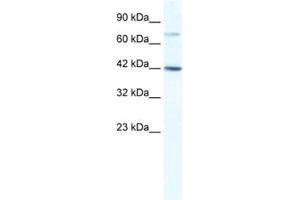Western Blotting (WB) image for anti-GLI Family Zinc Finger Protein 4 (GLI4) antibody (ABIN2461601) (GLI4 抗体)