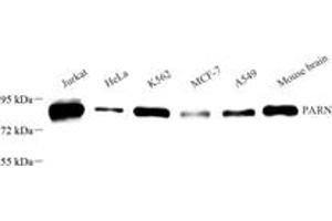 Western blot analysis of PARN (ABIN7075117),at dilution of 1: 1000 (PARN 抗体)