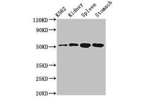 Western Blot Positive WB detected in: K562 whole cell lysate, Rat kidney tissue, Rat spleen tissue, Mouse stomach tissue All lanes: ALDH3B1 antibody at 3 μg/mL Secondary Goat polyclonal to rabbit IgG at 1/50000 dilution Predicted band size: 52, 48 kDa Observed band size: 52 kDa (ALDH3B1 抗体  (AA 168-449))