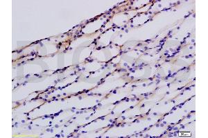 Immunohistochemistry (IHC) image for anti-Defensin, beta 1 (DEFB1) (AA 33-68) antibody (ABIN738591)