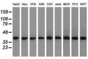 Image no. 8 for anti-Acetyl-CoA Acetyltransferase 2 (ACAT2) antibody (ABIN1496400) (ACAT2 抗体)