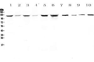 Western blot analysis of IDE using anti-IDE antibody . (IDE 抗体  (AA 485-756))