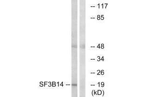 Western blot analysis of extracts from HepG2 cells, using SF3B14 antibody. (Pre-mRNA Branch Site Protein p14 (SF3B14) (C-Term) 抗体)