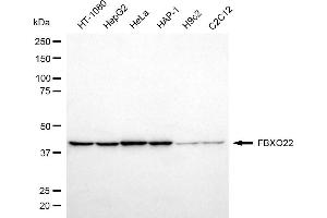 anti-F-Box Protein 22 (FBXO22) antibody