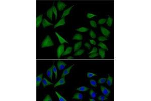 Immunofluorescence analysis of MCF7 cells using ATOX1 Polyclonal Antibody (ATOX1 抗体)