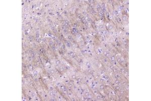 IHC testing of FFPE rat brain tissue with LC3A antibody at 1ug/ml. (MAP1LC3A 抗体)