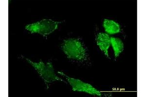 Immunofluorescence (IF) image for anti-Pyruvate Dehydrogenase Complex, Component X (PDHX) (AA 1-501) antibody (ABIN521742)