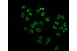 Immunofluorescence staining of Hela cells (treated with 30mM sodium butyrate for 4h) with ABIN7139147 at 1:2. (Histone H2B 抗体  (acLys108))