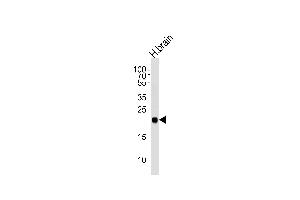 Western blot analysis of lysate from human brain tissue lysate, using CPLX3 Antibody (Center) (ABIN654609 and ABIN2844309). (CPLX3 抗体  (AA 52-81))