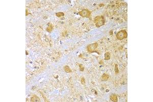 Immunohistochemistry of paraffin-embedded mouse brain using SPAG16 antibody at dilution of 1:100 (x400 lens). (SPAG16 抗体)