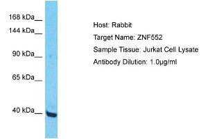Host: Rabbit Target Name: ZNF552 Sample Type: Jurkat Whole Cell lysates Antibody Dilution: 1. (ZNF552 抗体  (Middle Region))
