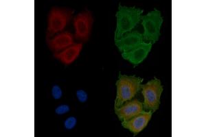 ABIN6260215 and ABIN6266858 staining Hela cells(24h of starvation treatment) by IF/ICC. (BCAR3 抗体  (C-Term))