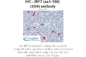 Image no. 1 for anti-Interferon Regulatory Factor 7 (IRF7) (AA 1-150) antibody (ABIN1723206) (IRF7 抗体  (AA 1-150))