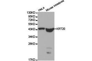 Western Blotting (WB) image for anti-Keratin 20 (KRT20) antibody (ABIN1873482) (KRT20 抗体)