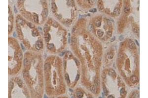 Immunohistochemical staining of formalin-fixed paraffin-embedded human fetal kidney tissue showing cytoplasmic and nuclear staining with PDCD5 polyclonal antibody  at 1 : 100 dilution. (PDCD5 抗体  (N-Term))