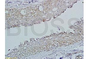 Immunohistochemistry (IHC) image for anti-Follicle Stimulating Hormone Receptor (FSHR) (AA 201-300) antibody (ABIN729508)
