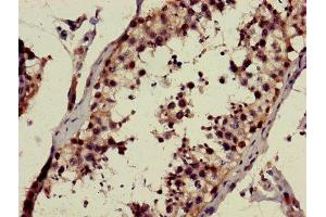 Immunohistochemistry of paraffin-embedded human testis tissue using ABIN7146692 at dilution of 1:100 (CHST9 抗体  (AA 33-129))