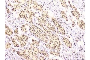 IHC analysis of RbAp48 using anti-RbAp48 antibody (ABIN5692929).