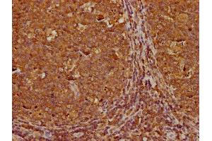 IHC image of ABIN7166965 diluted at 1:300 and staining in paraffin-embedded human tonsil tissue performed on a Leica BondTM system. (RABEP1 抗体  (AA 1-255))