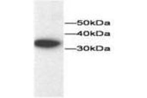 Image no. 1 for anti-Thioredoxin (TXN) antibody (ABIN791544) (TXN 抗体)