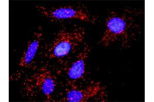 Proximity Ligation Analysis of protein-protein interactions between NUMB and APP. (NUMB 抗体  (AA 1-135))