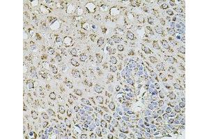 Immunohistochemistry of paraffin-embedded Human esophagus using TMC1 Polyclonal Antibody at dilution of 1:100 (40x lens).
