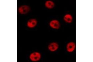Immunofluorescence (fixed cells) (IF/ICC) image for anti-cAMP Responsive Element Binding Protein 1 (CREB1) (pSer133) antibody (ABIN6256130)