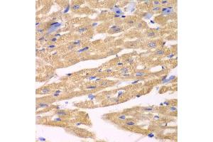 Immunohistochemistry of paraffin-embedded mouse heart using APLP1 antibody at dilution of 1:100 (x40 lens). (APLP1 抗体)