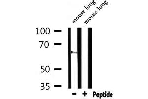 Western blot analysis of extracts from mouse lung, using CEACAM20 Antibody. (CEACAM20 抗体  (Internal Region))