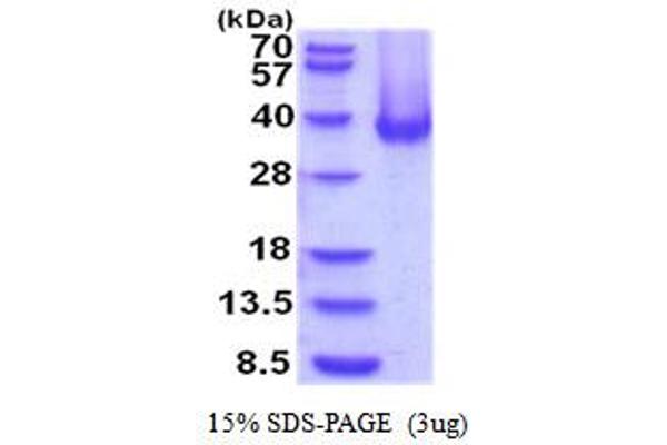 CA12 Protein (AA 25-301) (His tag)