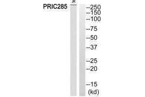 Western blot analysis of extracts from Jurkat cells, using PRIC285 antibody. (HELZ2 抗体)