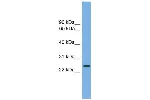 WB Suggested Anti-CHMP4B Antibody Titration: 0. (CHMP4B 抗体  (Middle Region))