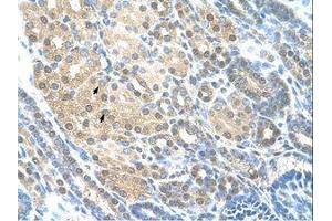 Image no. 1 for anti-RAD23 Homolog A (RAD23A) (AA 201-250) antibody (ABIN203508) (RAD23A 抗体  (AA 201-250))