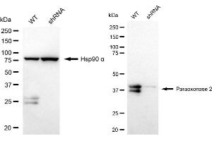 Western blotting analysis using Paraoxonase 2 antibody (ABIN7799735). (Recombinant PON2 抗体)