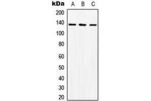 Western blot analysis of ABL1 expression in K562 (A), mouse liver (B), rat liver (C) whole cell lysates. (ABL1 抗体  (C-Term))
