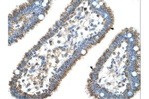 Immunohistochemistry (IHC) image for anti-Carbamoyl-Phosphate Synthase 1, Mitochondrial (CPS1) (Middle Region) antibody (ABIN2782319) (CPS1 抗体  (Middle Region))