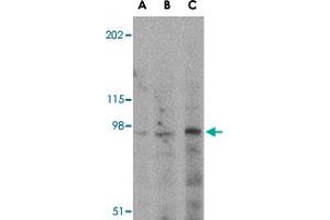 Western blot analysis of GRIK5 in human brain tissue lysate with GRIK5 polyclonal antibody  at (A) 0. (GRIK5 抗体  (C-Term))