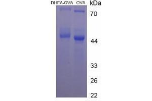 Image no. 2 for Dehydroepiandrosterone (DHEA) protein (Ovalbumin) (ABIN1880133) (DHEA Protein (Ovalbumin))