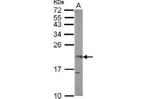 WB Image Sample (50 ug of whole cell lysate) A: mouse brain 12% SDS PAGE antibody diluted at 1:1000 (FGF12 抗体)