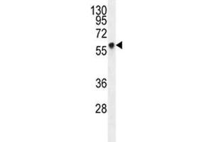 Western Blotting (WB) image for anti-Glypican 3 (GPC3) (AA 335-365) antibody (ABIN3031099)