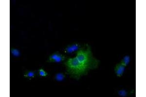 Anti-TBXAS1 mouse monoclonal antibody (ABIN2453710) immunofluorescent staining of COS7 cells transiently transfected by pCMV6-ENTRY TBXAS1 (RC208028). (TBXAS1 抗体)