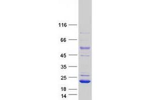 Validation with Western Blot (PLA2G16 Protein (Transcript Variant 1) (Myc-DYKDDDDK Tag))