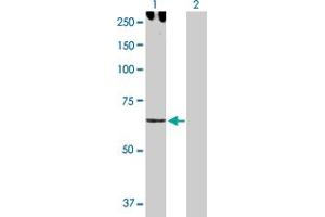 Western Blot analysis of CDH6 expression in transfected 293T cell line by CDH6 MaxPab polyclonal antibody. (CDH6 抗体  (AA 1-663))
