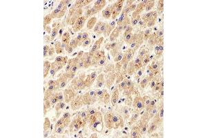 Immunohistochemical analysis of paraffin-embedded H. (PDIA6 抗体  (AA 144-172))