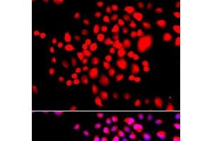 Immunofluorescence analysis of A549 cells using STK19 Polyclonal Antibody (STK19 抗体)