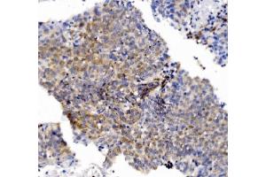 IHC analysis of CHCHD10 using anti-CHCHD10 antibody (ABIN7602507). (CHCHD10 抗体  (AA 80-142))